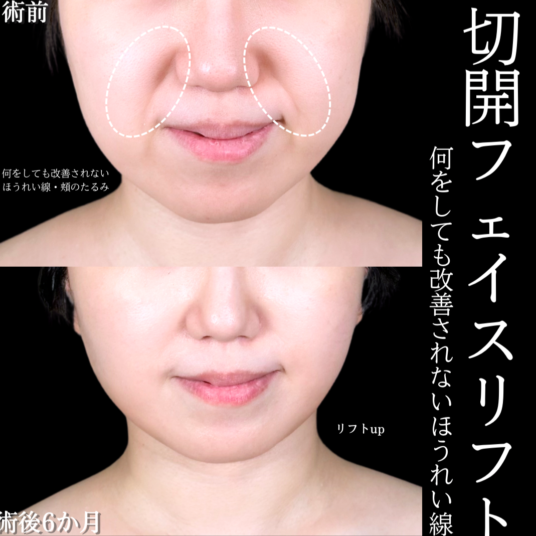 No.15797の症例写真1